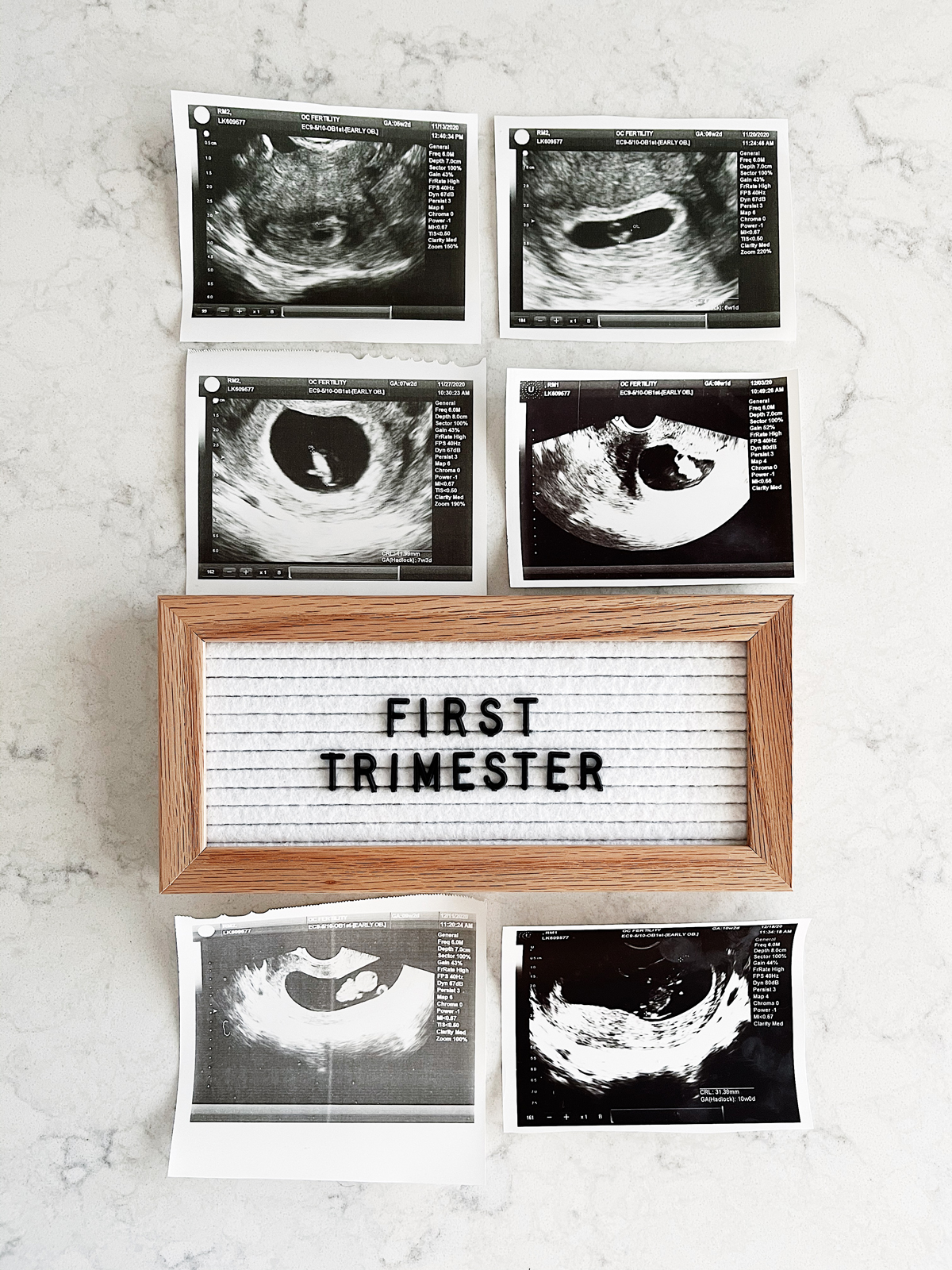eatsleepwear celebrates first trimester of pregnancy ultrasound photos